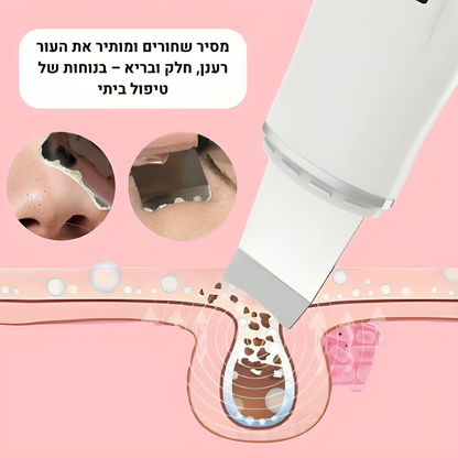 המנקה שחורים מהפנים - ספייקי